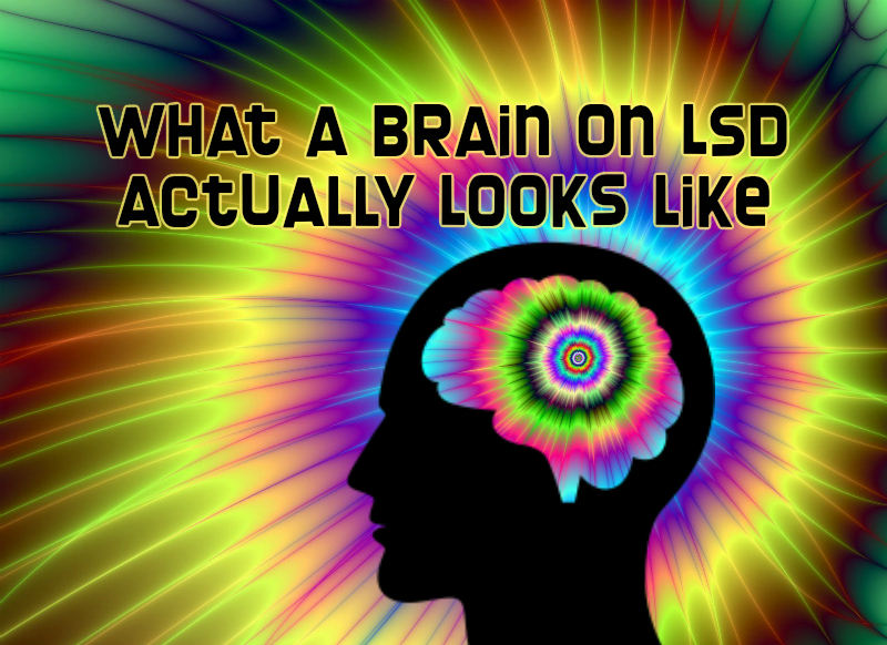 brain on lsd