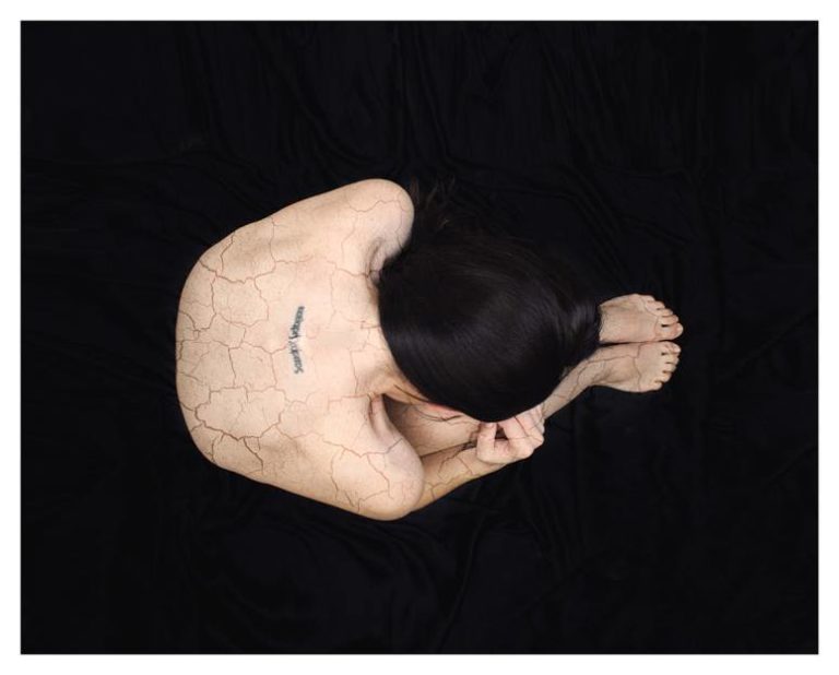 Read more about the article Powerful Photos Capture What Life with Anxiety Is Like